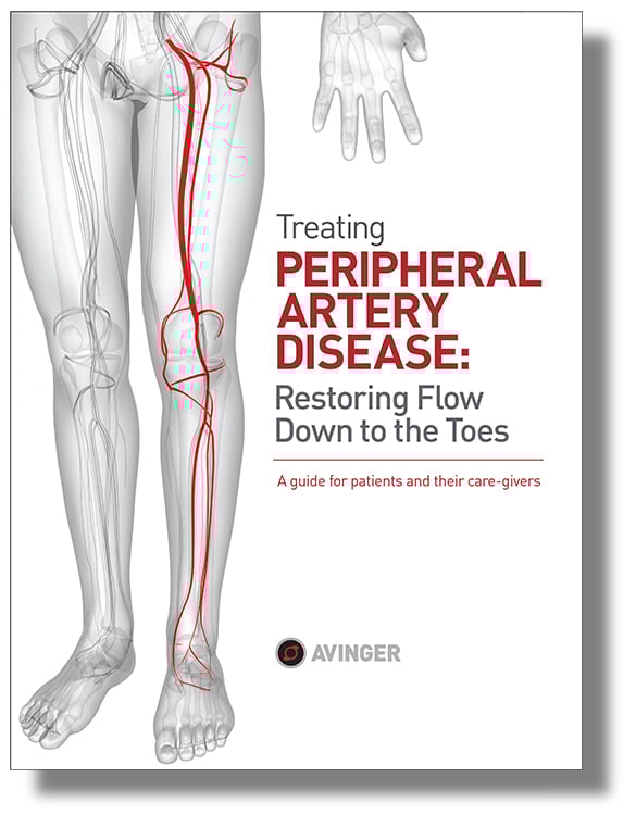 Peripheral Artery Disease Patient Guide Restoring Flow Down To The Toes peripheral-artery-disease-patient-guide-restoring-flow-down-to-the-toes